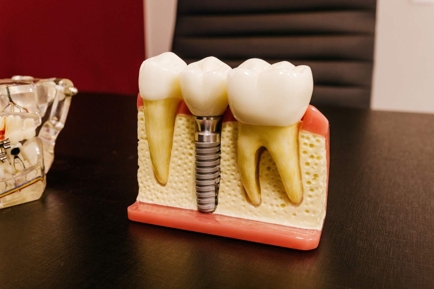 Dental Implant Training Institute in Delhi NCR