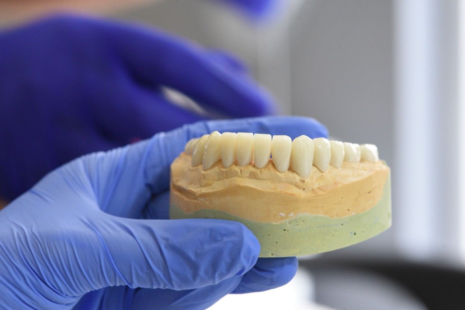 Dental Implant Institute in Delhi NCR
